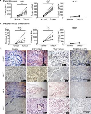 Preclinical evidence for anaplastic lymphoma kinase inhibitors as novel therapeutic treatments for cholangiocarcinoma